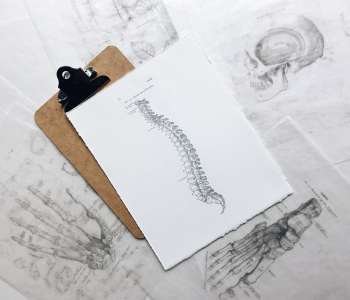 Multiple Sclerosis 